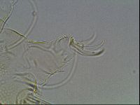 Testechiniscus laterculus image