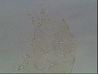 Testechiniscus laterculus image