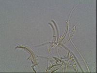 Testechiniscus laterculus image