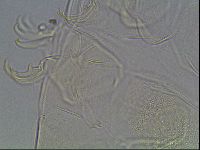 Testechiniscus laterculus image