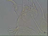 Testechiniscus laterculus image