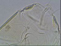 Testechiniscus laterculus image