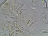 Testechiniscus laterculus image