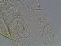 Testechiniscus laterculus image