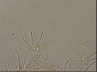 Testechiniscus laterculus image