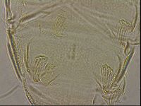Testechiniscus laterculus image