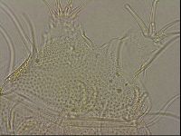 Testechiniscus laterculus image