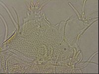 Testechiniscus laterculus image