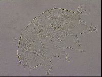 Testechiniscus laterculus image