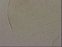 Testechiniscus laterculus image