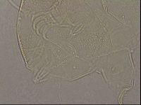 Testechiniscus laterculus image