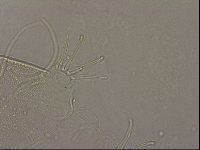 Testechiniscus laterculus image