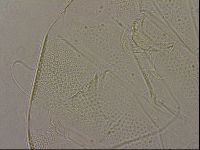 Testechiniscus laterculus image