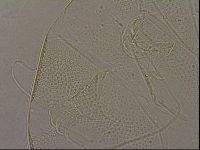 Testechiniscus laterculus image