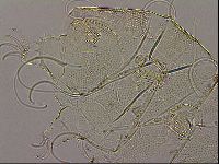 Testechiniscus laterculus image