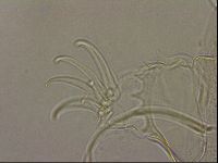 Testechiniscus laterculus image