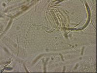 Testechiniscus laterculus image