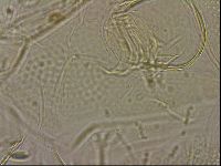 Testechiniscus laterculus image