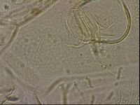 Testechiniscus laterculus image