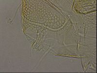 Testechiniscus laterculus image