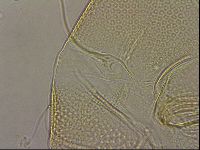 Testechiniscus laterculus image