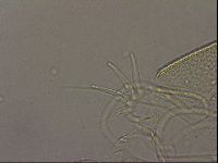 Testechiniscus laterculus image