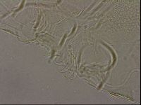 Testechiniscus laterculus image