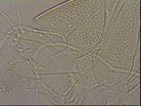 Testechiniscus laterculus image