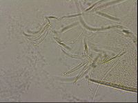 Testechiniscus laterculus image