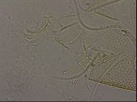 Testechiniscus laterculus image