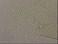 Testechiniscus laterculus image