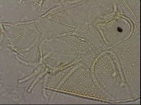 Testechiniscus laterculus image
