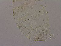Testechiniscus laterculus image