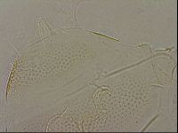 Testechiniscus laterculus image