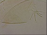 Testechiniscus laterculus image