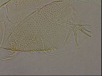 Testechiniscus laterculus image