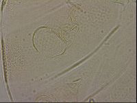 Testechiniscus laterculus image