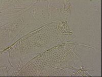 Testechiniscus laterculus image
