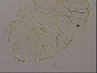 Testechiniscus laterculus image