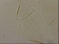 Testechiniscus laterculus image