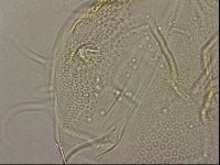 Testechiniscus laterculus image