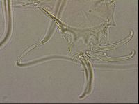 Testechiniscus laterculus image
