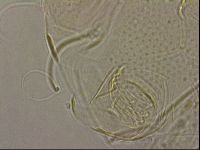 Testechiniscus laterculus image