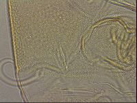Testechiniscus laterculus image