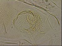 Testechiniscus laterculus image