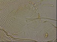 Testechiniscus laterculus image