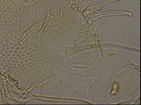 Testechiniscus laterculus image