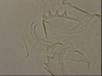 Testechiniscus laterculus image