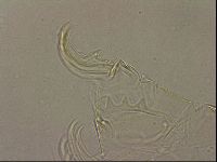Testechiniscus laterculus image