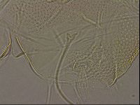 Testechiniscus laterculus image
